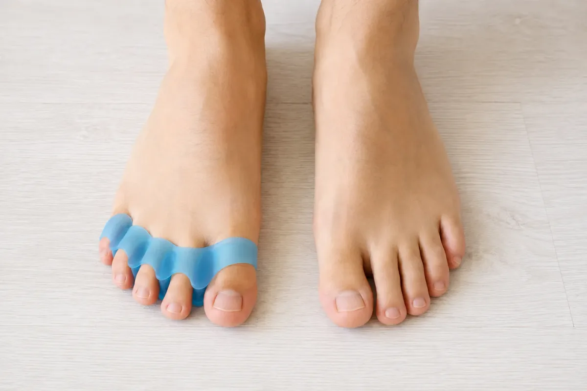 One bare foot wearing a blue five-toe gel spacer beside one bare foot without, side by side