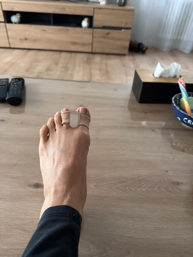 Toe spacers photographed by Mila R., a verified buyer